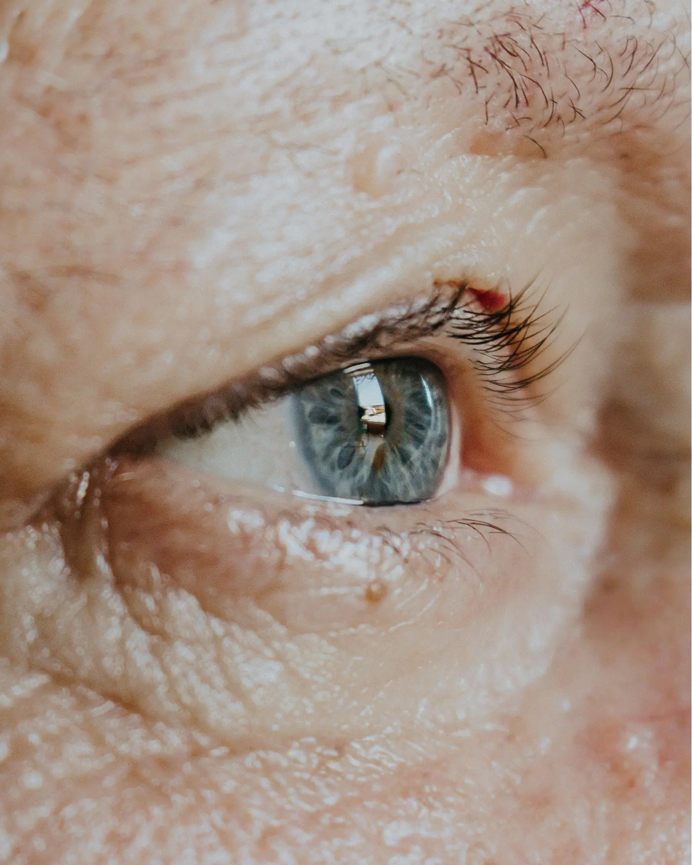 Hintere Glaskörperabhebung Auge