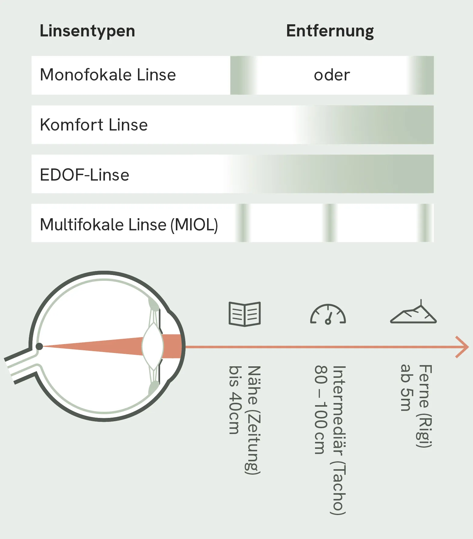 Linseneigenschaften, Monofokal, Komfortlinse, EDOF, Multifokale Linse
