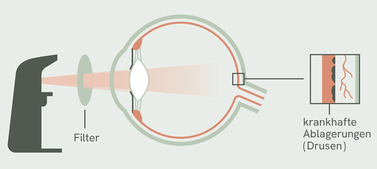 Photobiomodulation, PBM, Schema